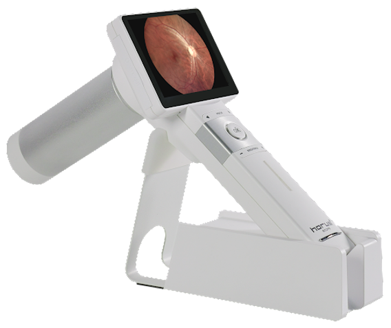 camera-noi-soi-horus-scope-cho-chat-luong-hinh-anh-cao-va-on-dinh-1632463247.png