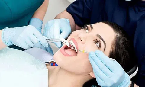 Đi nhổ răng có được bảo hiểm y tế chi trả?