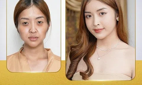 Cùng Tái sinh đa tầng tiên phong trong dịch vụ làm đẹp không xâm lấn, an toàn hiệu quả tuyệt tối