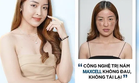 Hãy để Max Cell xóa bỏ nám, hiện thực hóa ước mơ sở hữu làn da sáng mịn chỉ trong vòng 60 phút