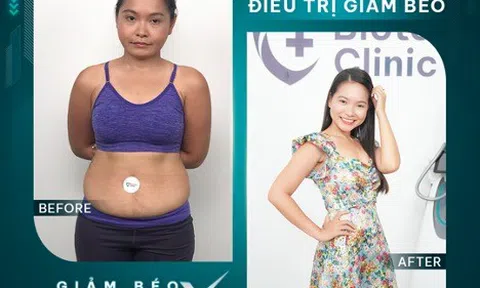 Bật mí cách giảm cân thần tốc không cần ăn kiêng mang tên Giảm béo BioMaxthin